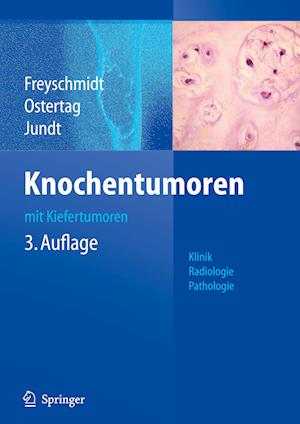 Knochentumoren mit Kiefertumoren