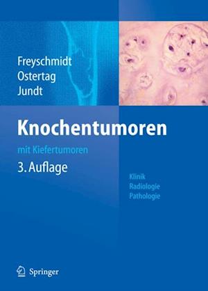 Knochentumoren mit Kiefertumoren