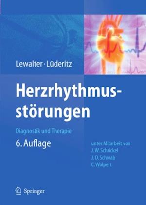 Herzrhythmusstörungen