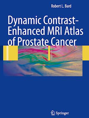 Dynamic Contrast-Enhanced MRI Atlas of Prostate Cancer