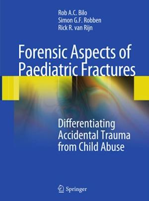 Forensic Aspects of Pediatric Fractures