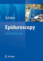 Epiduroscopy