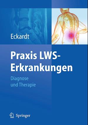 Praxis LWS-Erkrankungen