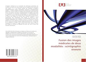 Fusion des images médicales de deux modalités : scintigraphie osseuse