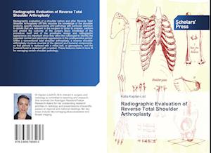 Radiographic Evaluation of Reverse Total Shoulder Arthroplasty