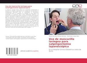 Uso de mascarilla laríngea para salpingectomia laparoscópica