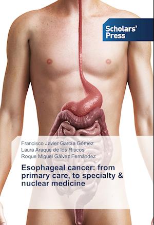 Esophageal cancer: from primary care, to specialty & nuclear medicine