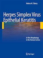 Herpes Simplex Virus Epithelial Keratitis