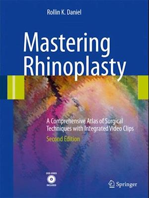 Mastering Rhinoplasty