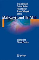 Malassezia and the Skin