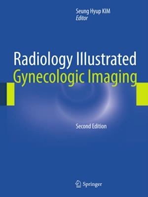 Radiology Illustrated: Gynecologic Imaging