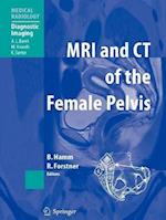MRI and CT of the Female Pelvis