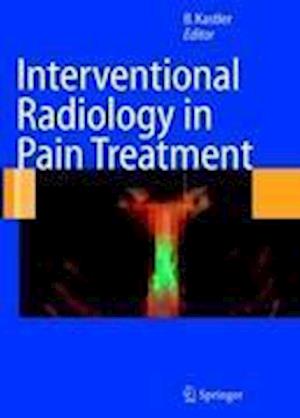 Interventional Radiology in Pain Treatment