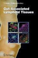 Gut-Associated Lymphoid Tissues