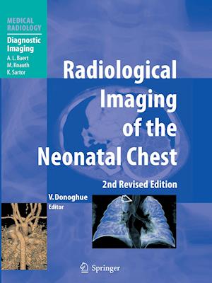 Radiological Imaging of the Neonatal Chest