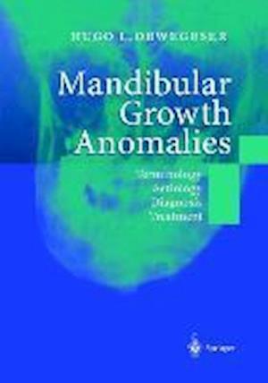 Mandibular Growth Anomalies