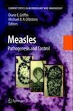 Measles