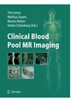 Clinical Blood Pool MR Imaging