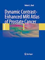 Dynamic Contrast-Enhanced MRI Atlas of Prostate Cancer