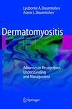 Dermatomyositis