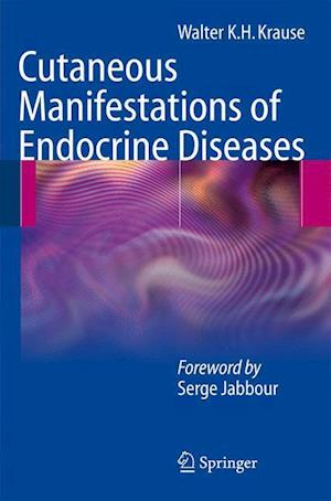 Cutaneous Manifestations of Endocrine Diseases