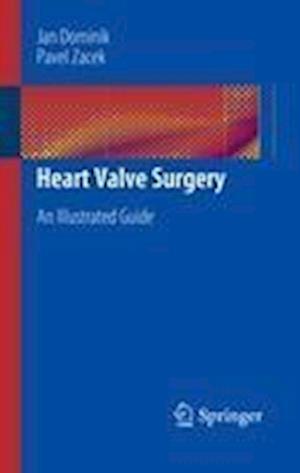 Heart Valve Surgery