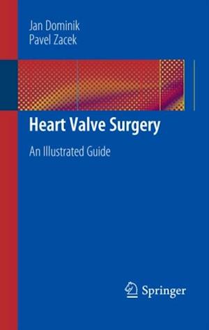 Heart Valve Surgery