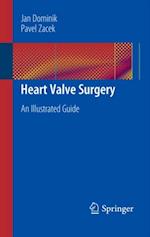 Heart Valve Surgery