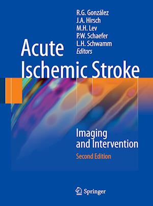 Acute Ischemic Stroke