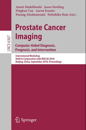 Prostate Cancer Imaging: Computer-Aided Diagnosis, Prognosis, and Intervention