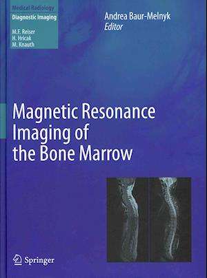 Magnetic Resonance Imaging of the Bone Marrow