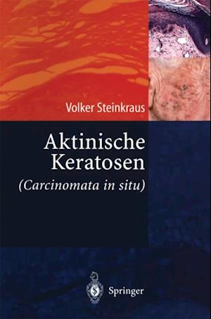 Aktinische Keratosen (Carcinomata in situ)