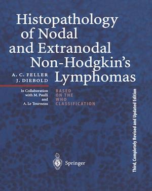 Histopathology of Nodal and Extranodal Non-Hodgkin's Lymphomas