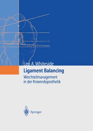 Ligament Balancing