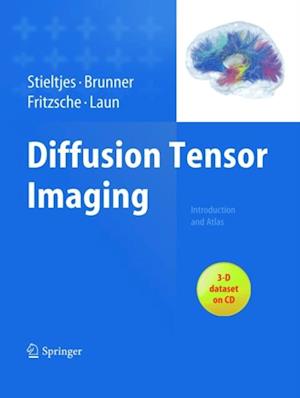 Diffusion Tensor Imaging