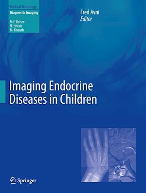 Imaging Endocrine Diseases in Children