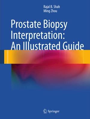 Prostate Biopsy Interpretation: An Illustrated Guide