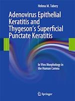 Adenovirus Epithelial Keratitis and Thygeson's Superficial Punctate Keratitis