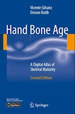 Hand Bone Age