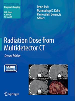 Radiation Dose from Multidetector CT