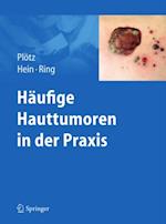 Häufige Hauttumoren in der Praxis