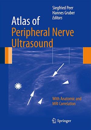 Atlas of Peripheral Nerve Ultrasound