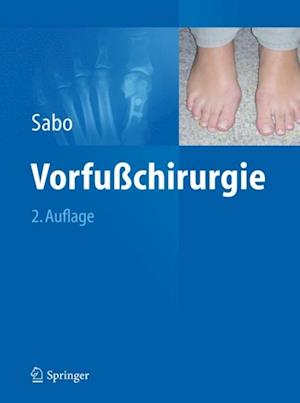 Vorfußchirurgie