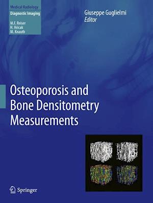 Osteoporosis and Bone Densitometry Measurements