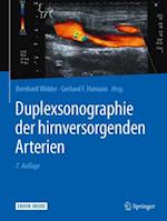 Duplexsonographie der hirnversorgenden Arterien