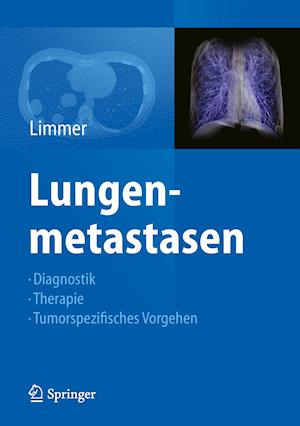 Lungenmetastasen