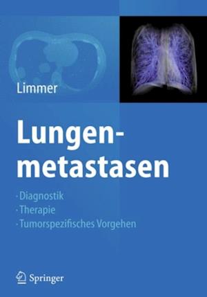 Lungenmetastasen