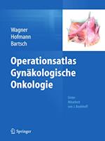 Operationsatlas Gynäkologische Onkologie