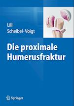 Die proximale Humerusfraktur