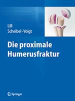 Die proximale Humerusfraktur